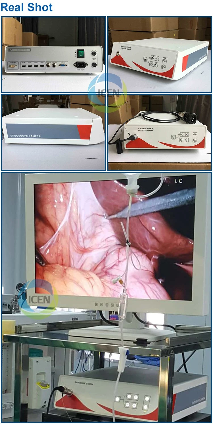 IN-GW800 China Top Sale Medical Endoscope Camera Disposable Industrial Laparoscopic Needle Holder 360 Degree Laparoscopy