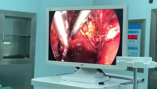 Medical Endoscopic Equipment 900 Lines